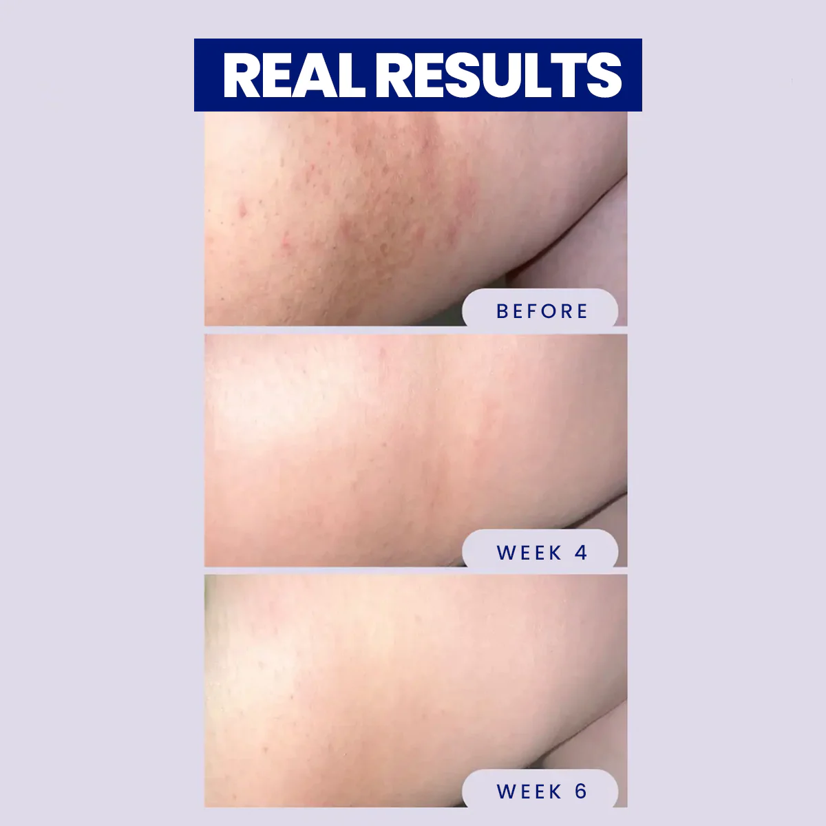 Night Rescue Overnight Brightening Stick - Image 4